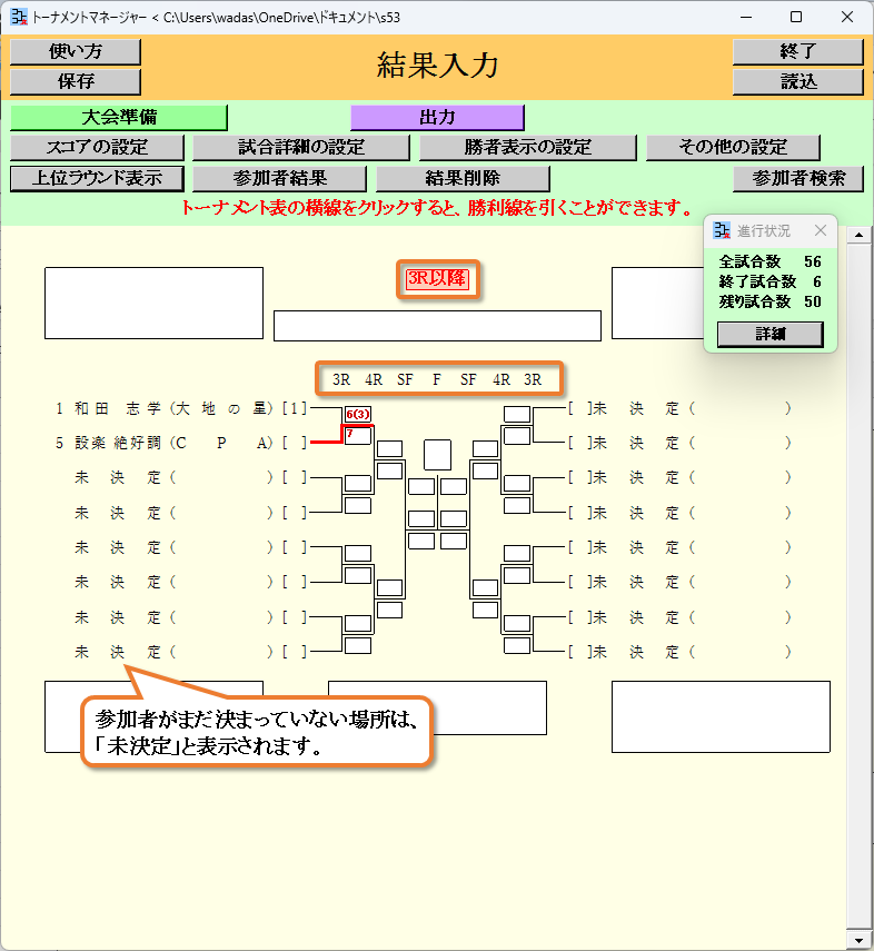 トーナメント表の上位ラウンドのみを表示